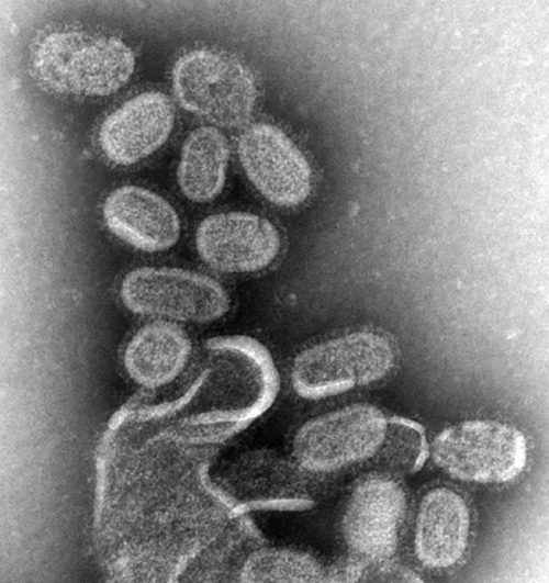 EM_of_influenza_virus-500x531.jpg